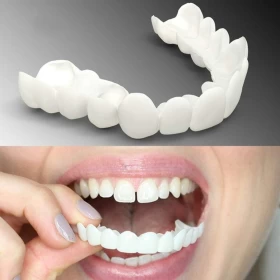Snapon Smile Teeth Veneer - Fake Teeth